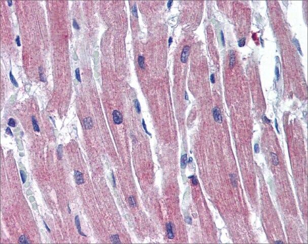 Anti-TNNI3