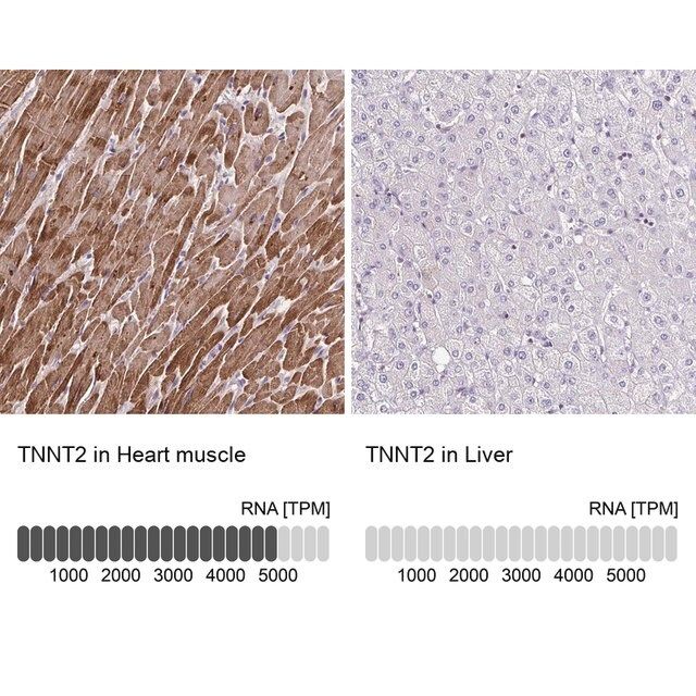 Anti-TNNT2 antibody produced in rabbit