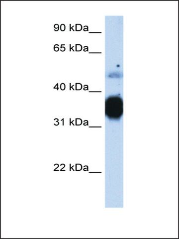 Anti-TNNT3 antibody produced in rabbit