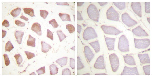 Anti-TNNI3 antibody produced in rabbit