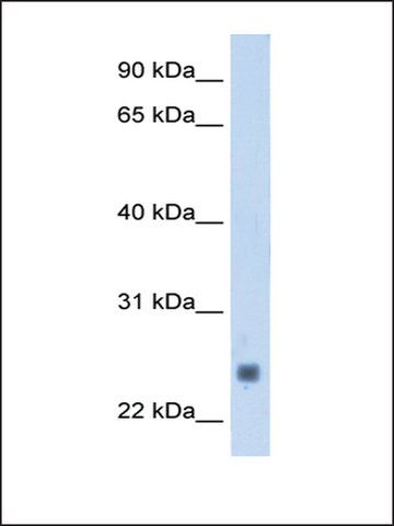 Anti-TNNI2 antibody produced in rabbit