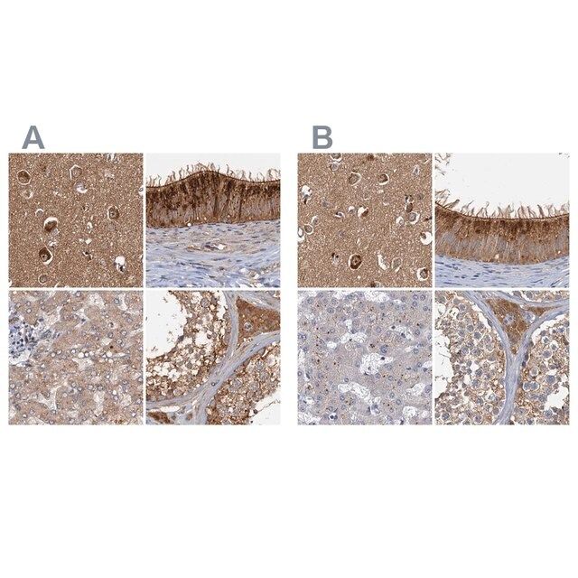 Anti-TOLLIP antibody produced in rabbit