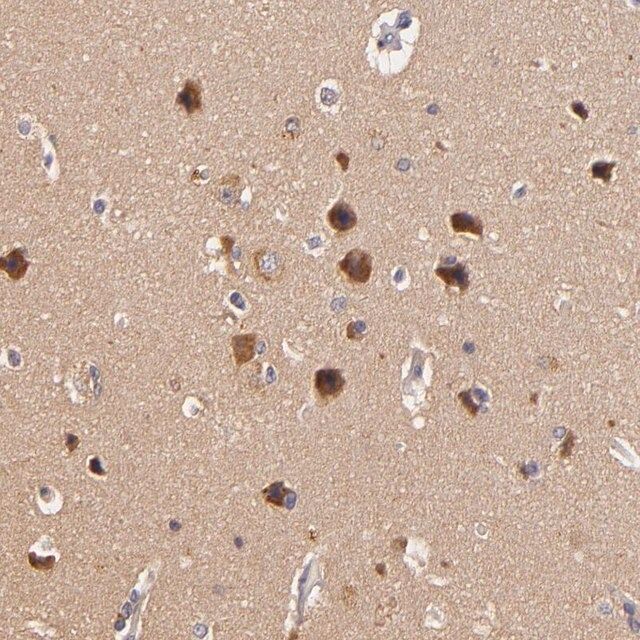 Anti-TOM1 antibody produced in rabbit