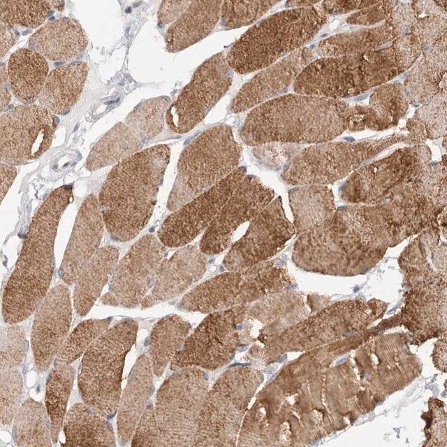Anti-TONSL antibody produced in rabbit