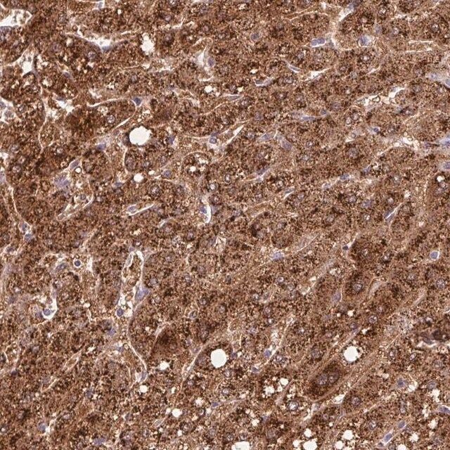 Anti-TONSL antibody produced in rabbit
