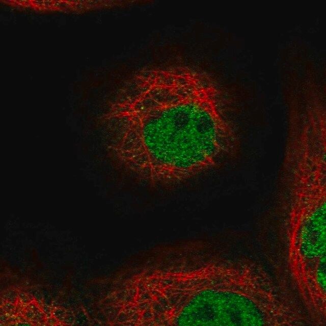 Anti-TOGARAM1 antibody produced in rabbit