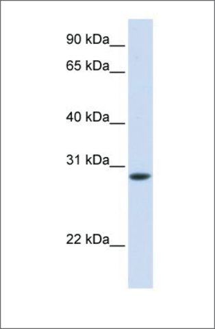 Anti-TNNT3 antibody produced in rabbit