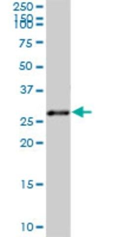Anti-TOLLIP antibody produced in mouse