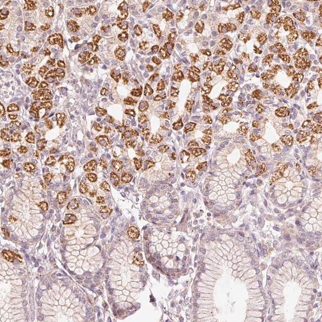 Anti-TOB2 antibody produced in rabbit