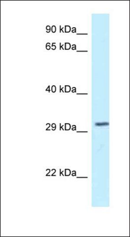 Anti-TOLLIP antibody produced in rabbit