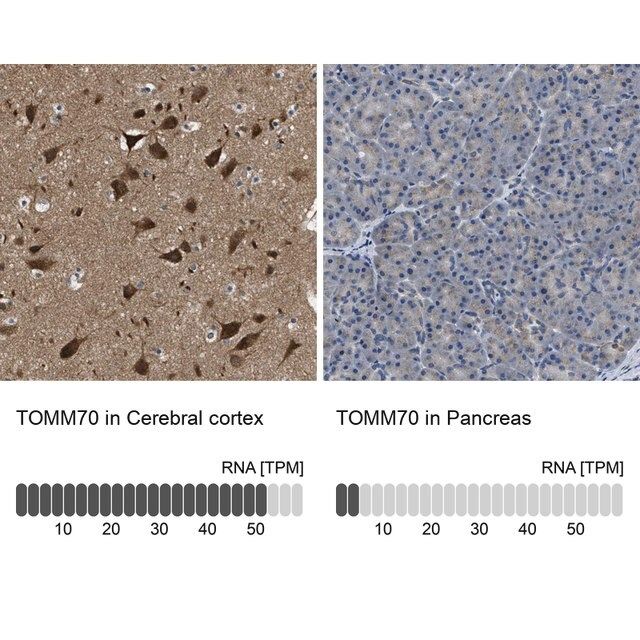 Anti-TOMM70 antibody produced in rabbit