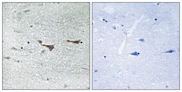 Anti-TOB1 antibody produced in rabbit