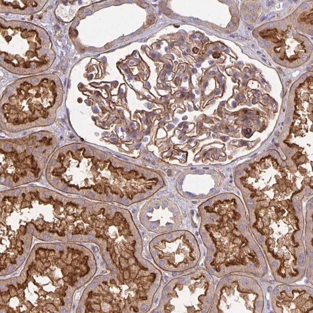 Anti-TNS3 antibody produced in rabbit