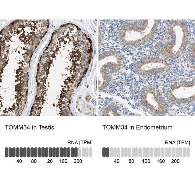 Anti-TOMM34 antibody produced in rabbit
