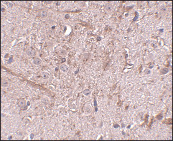 Anti-TOM70 antibody produced in rabbit