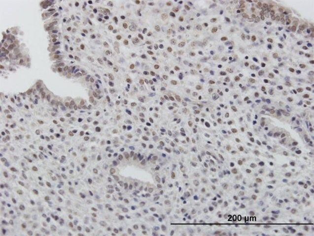 Anti-TOB1 antibody produced in mouse