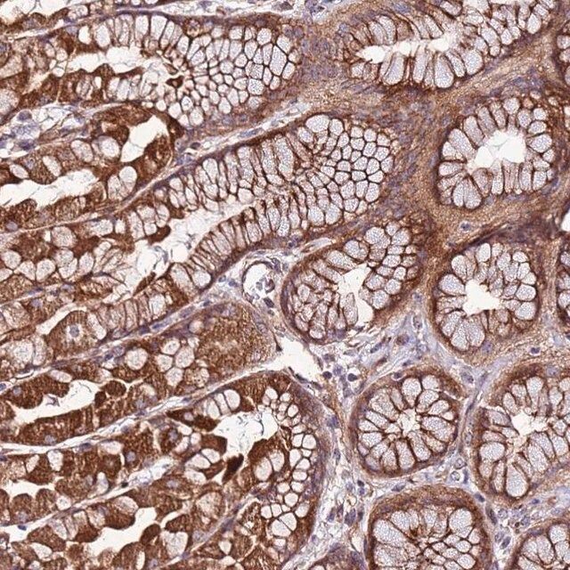 Anti-TOPAZ1 antibody produced in rabbit