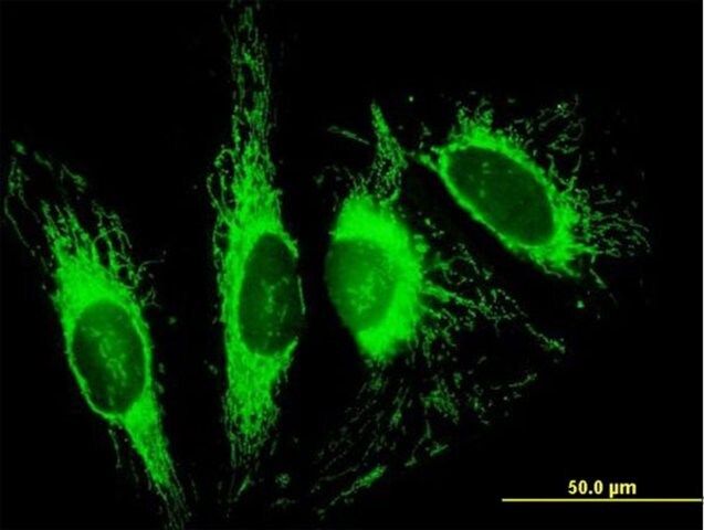 Anti-TOMM70A antibody produced in mouse