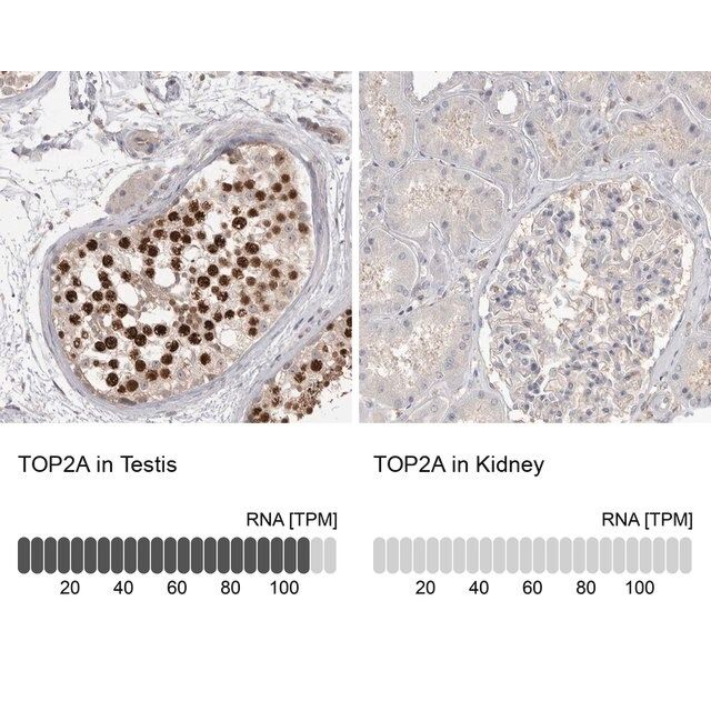Anti-TOP2A antibody produced in rabbit