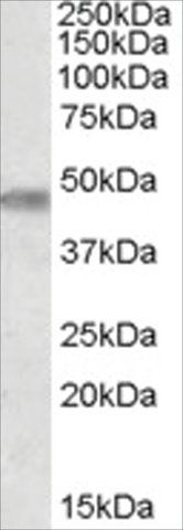 Anti-TOM1L1/SRCASM antibody produced in goat