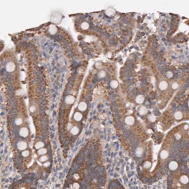 Anti-TOM1L1 antibody produced in rabbit