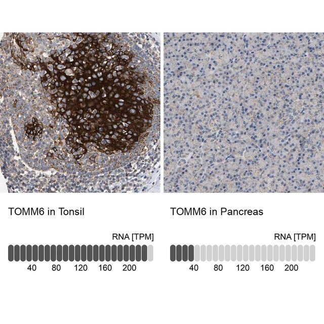Anti-TOMM6 antibody produced in rabbit