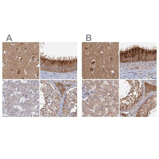 Anti-TOLLIP antibody produced in rabbit