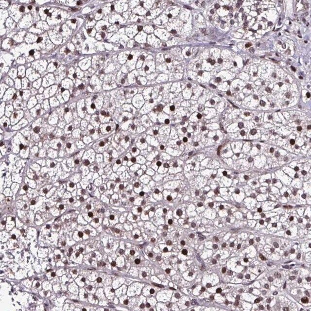 Anti-TOB1 antibody produced in rabbit