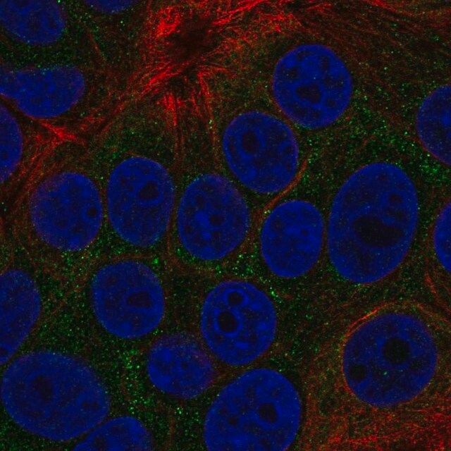 Anti-TOB2 antibody produced in rabbit