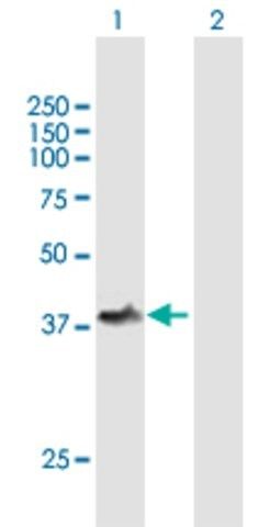 Anti-TOM1L1 antibody produced in mouse