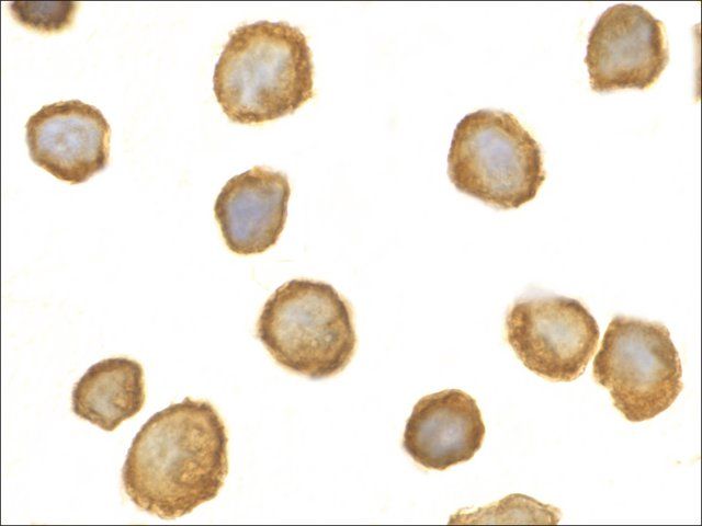 Anti-TOLLIP (ab2) antibody produced in rabbit