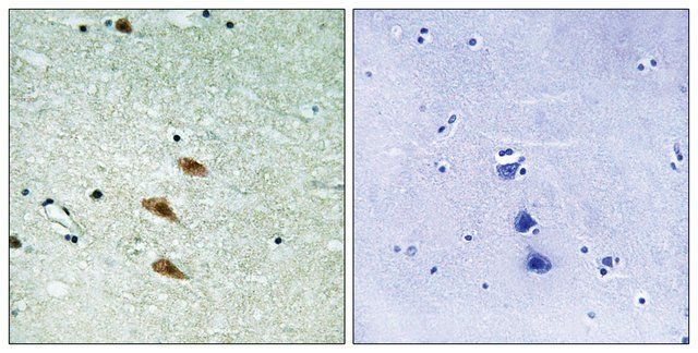 Anti-TOP2A, antibody produced in rabbit