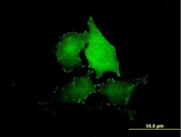 Anti-TNS4 antibody produced in mouse