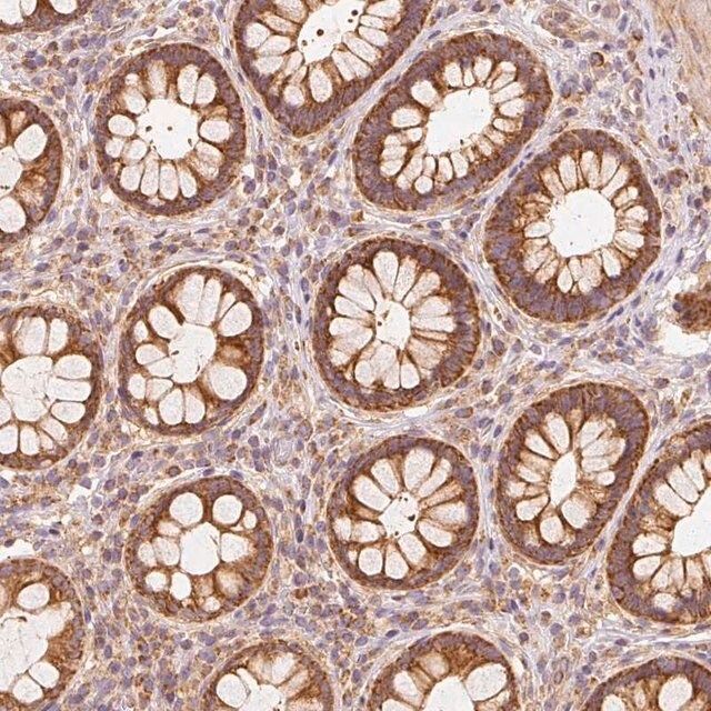 Anti-TOMM40 antibody produced in rabbit