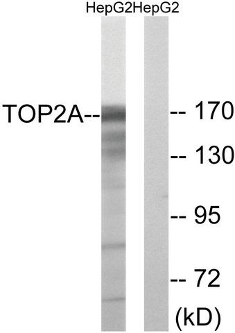 Anti-TOP2A antibody produced in rabbit