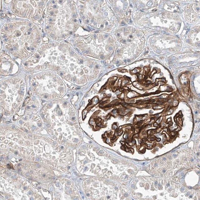 Anti-TNS2 antibody produced in rabbit