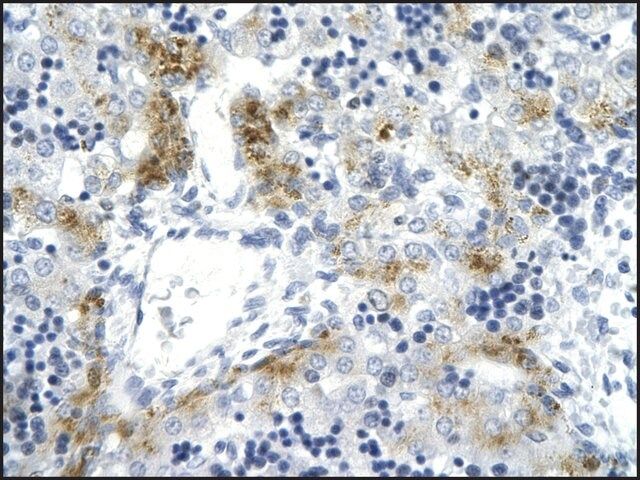 Anti-TOP2A antibody produced in rabbit