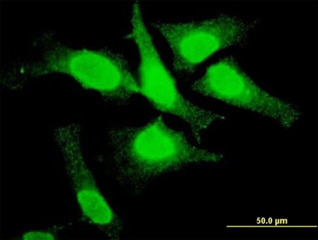 ANTI-TOP3B antibody produced in mouse