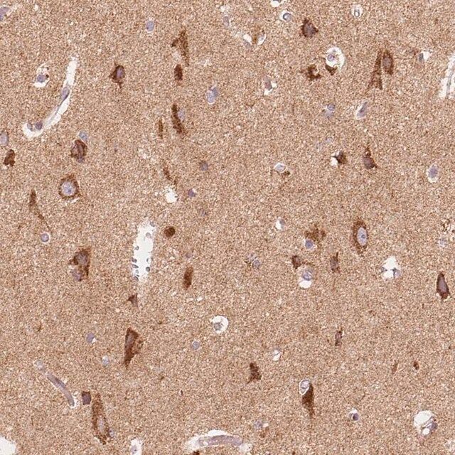 Anti-TOMM70 antibody produced in rabbit