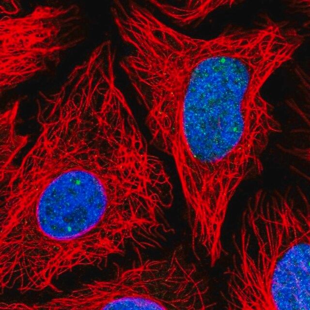 Anti-TOE1 antibody produced in rabbit