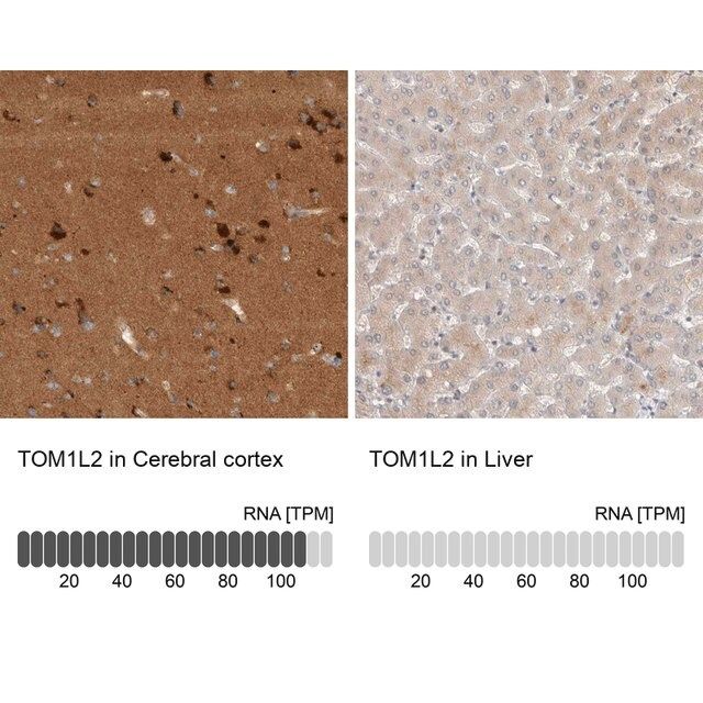 Anti-TOM1L2 antibody produced in rabbit