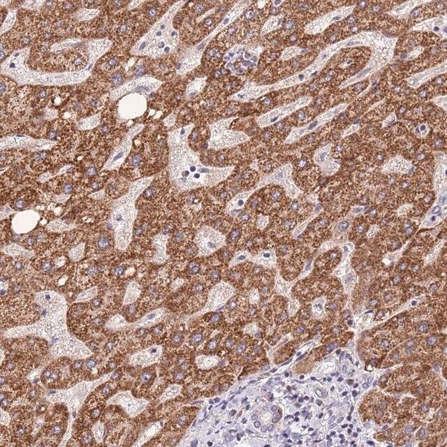 Anti-TOPAZ1 antibody produced in rabbit