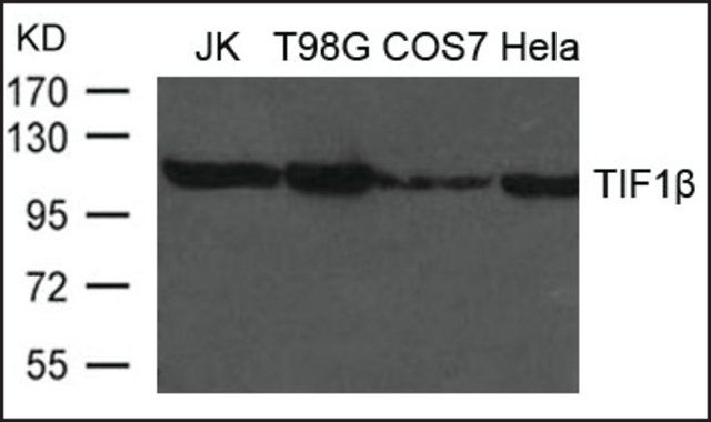 Anti-TIF1β antibody produced in rabbit