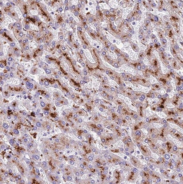 Anti-THRSP antibody produced in rabbit
