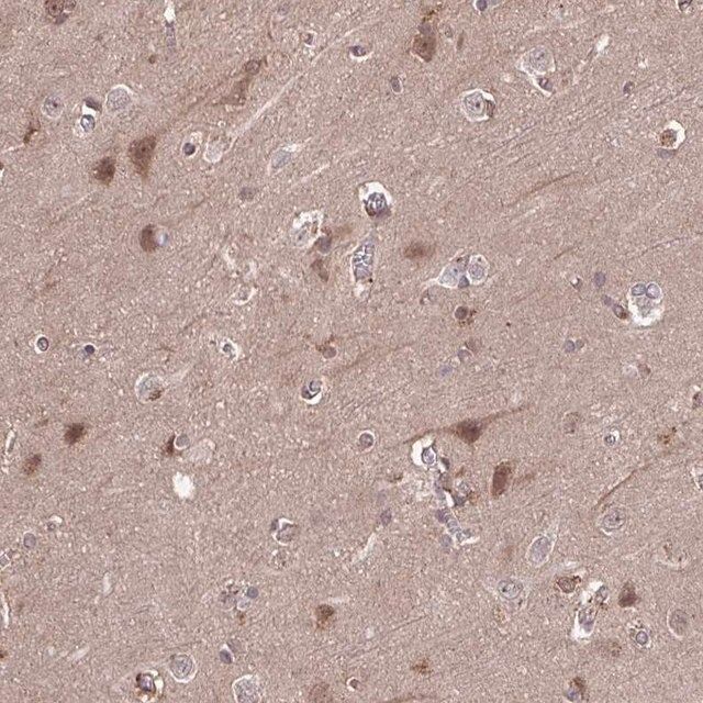 Anti-TIGAR antibody produced in rabbit