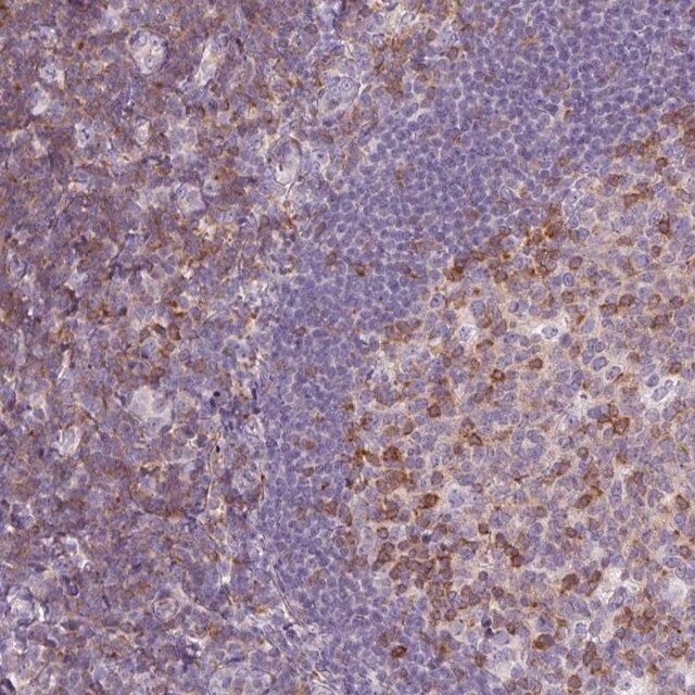 Anti-TIGD2 antibody produced in rabbit