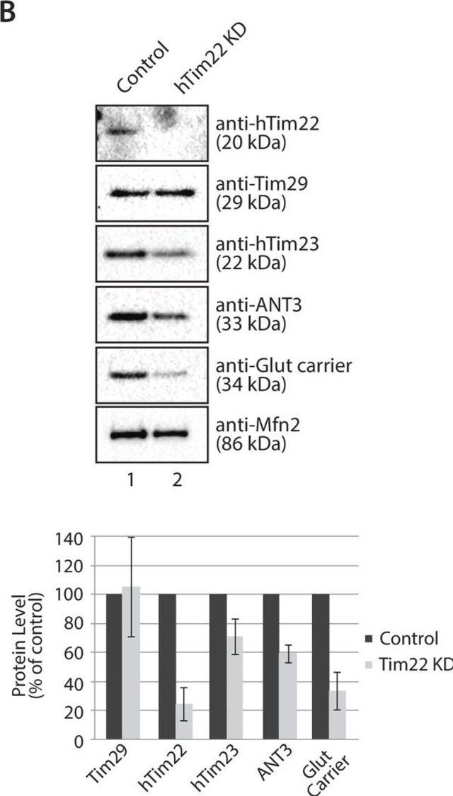 Anti-TIMM29 antibody produced in rabbit