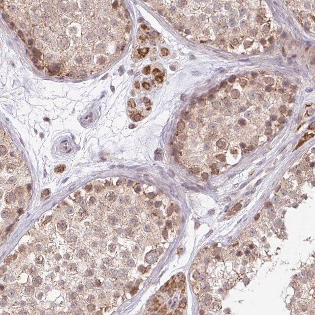 Anti-TIMM50 antibody produced in rabbit