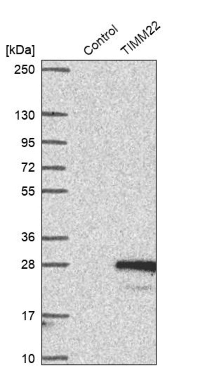 Anti-TIMM22 antibody produced in rabbit