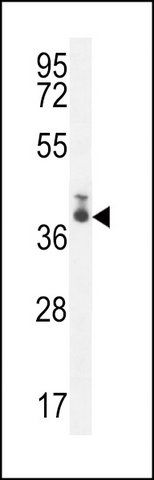 ANTI-TMEM66 (N-TERM) antibody produced in rabbit